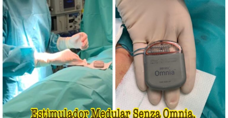 El Dr. Jesús Maldonado implanta el primer Estimulador Medular Senza Omnia en Andalucía Oriental.