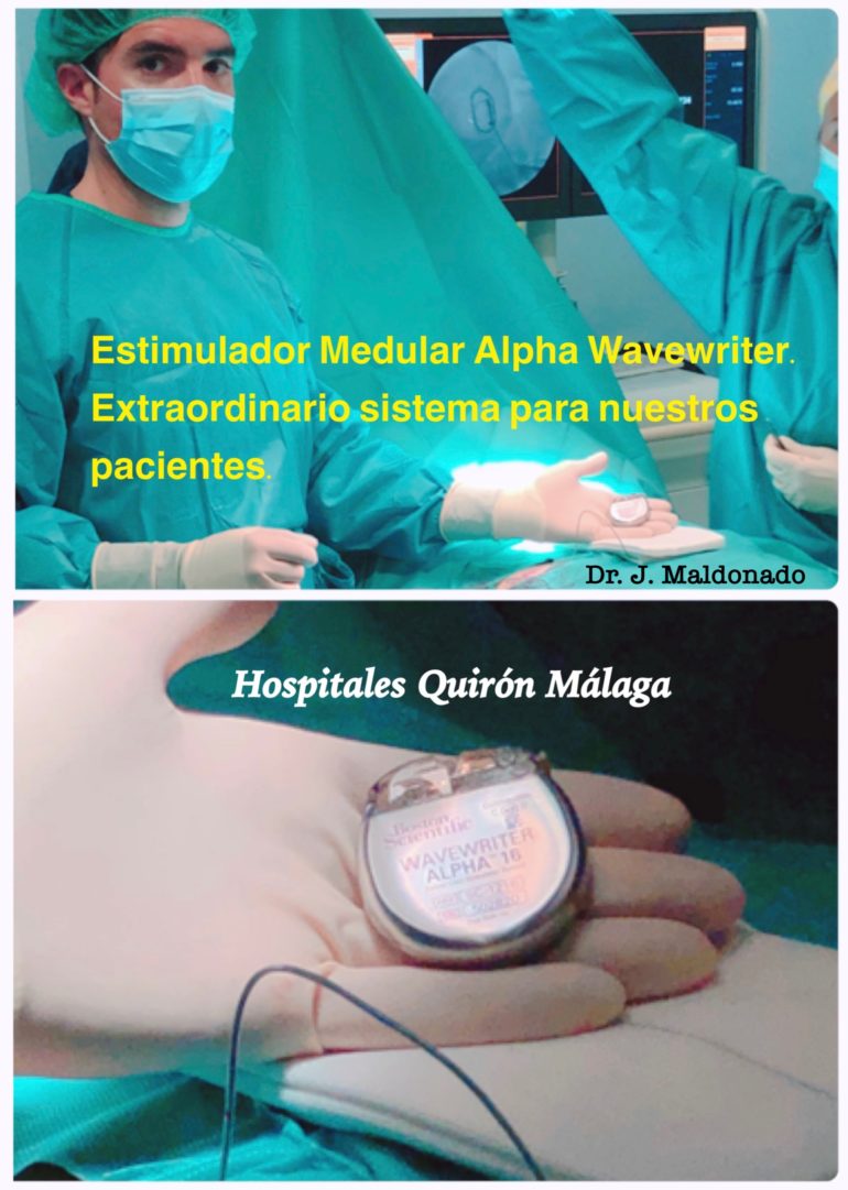 Implante en Hospital QuironSalud Málaga del  Estimulador Medular Alpha Wavewriter. Buscando la mejor tecnología para cada paciente.